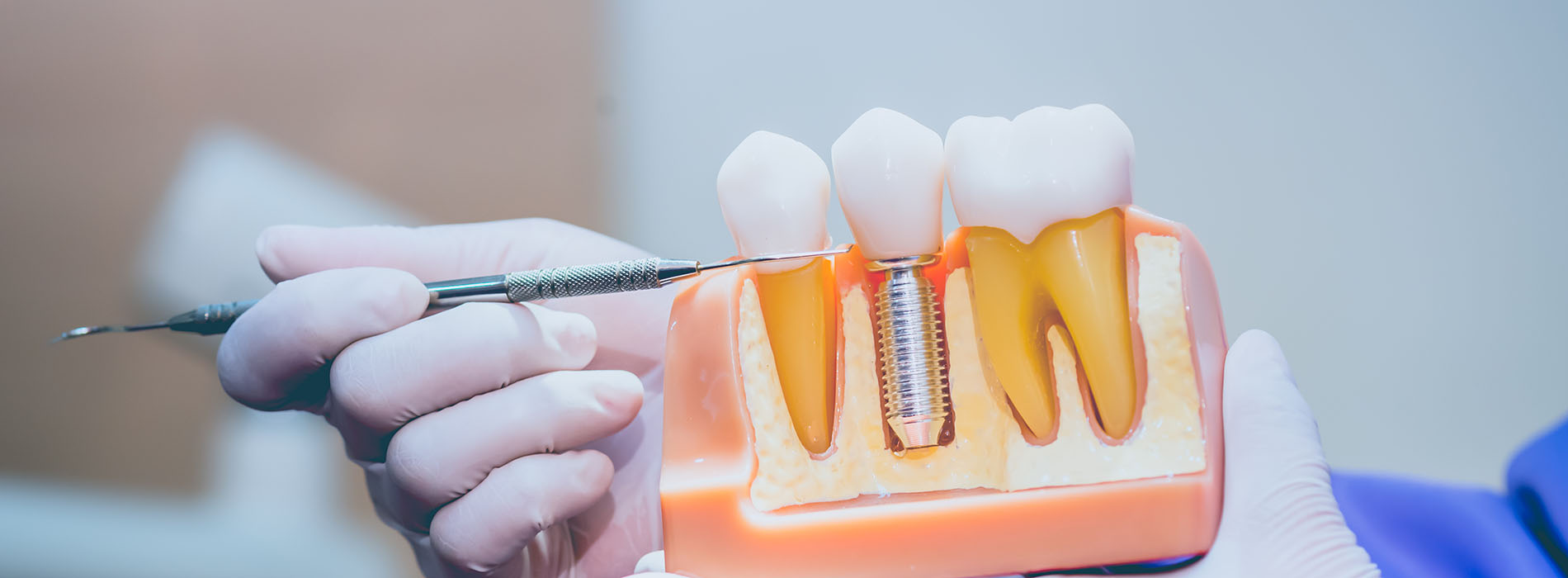 Downtown Parker Dental | Periodontal Treatment, Oral Exams and Sports Mouthguards
