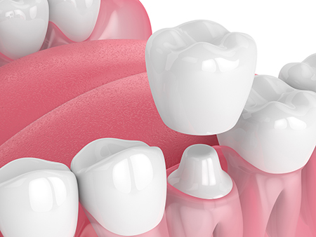Downtown Parker Dental