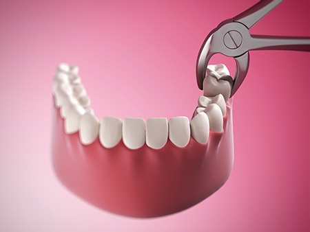 Downtown Parker Dental