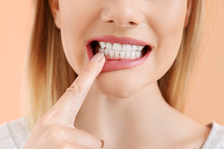 Downtown Parker Dental
